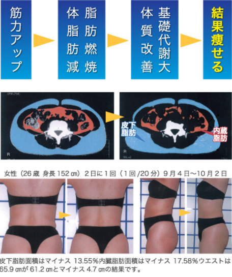 (複合高周波EMS)美のスパイラル