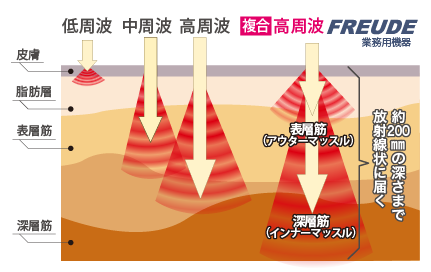複合高周波EMSの波形