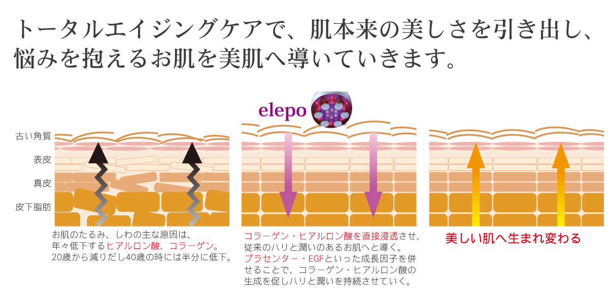 連射式ハイスピード脱毛機LEONレオン